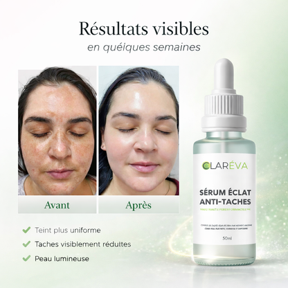 Sérum Éclat Anti-Taches